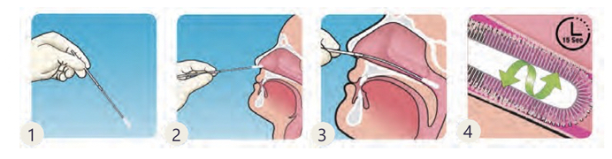 Nasopharynge Swab